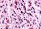 Gamma-Aminobutyric Acid Type B Receptor Subunit 1 antibody, orb85203, Biorbyt, Immunohistochemistry paraffin image 