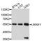 Lectin, Mannose Binding 1 antibody, A10440, ABclonal Technology, Western Blot image 