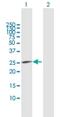 Cyclin Dependent Kinase Inhibitor 3 antibody, H00001033-B02P, Novus Biologicals, Western Blot image 