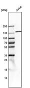 Tripeptidyl Peptidase 2 antibody, NBP1-86022, Novus Biologicals, Western Blot image 