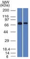 Endoglin antibody, GTX34454, GeneTex, Western Blot image 