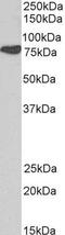 Cortactin antibody, GTX21374, GeneTex, Western Blot image 