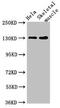 Period Circadian Regulator 3 antibody, CSB-PA017788LA01HU, Cusabio, Western Blot image 