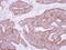 Mitochondrial Ribosomal Protein L28 antibody, PA5-30391, Invitrogen Antibodies, Immunohistochemistry paraffin image 