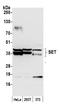 SET Nuclear Proto-Oncogene antibody, NBP1-26646, Novus Biologicals, Western Blot image 