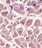 Myosin Binding Protein C, Cardiac antibody, PA5-71701, Invitrogen Antibodies, Immunohistochemistry paraffin image 
