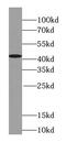 Syntaxin-18 antibody, FNab08449, FineTest, Western Blot image 