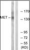 c-met antibody, orb96316, Biorbyt, Western Blot image 