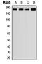 Alpha-2-Macroglobulin antibody, MBS8241275, MyBioSource, Western Blot image 