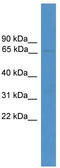 Ubiquitin Specific Peptidase 30 antibody, TA339620, Origene, Western Blot image 