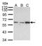 Transketolase Like 1 antibody, PA5-28977, Invitrogen Antibodies, Western Blot image 