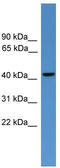 Glutamate-Ammonia Ligase antibody, TA342667, Origene, Western Blot image 