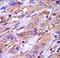 Casein Kinase 1 Epsilon antibody, LS-C100599, Lifespan Biosciences, Immunohistochemistry paraffin image 