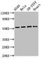 Autophagy Related 4D Cysteine Peptidase antibody, LS-C399027, Lifespan Biosciences, Western Blot image 