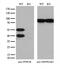 Protein Phosphatase, Mg2+/Mn2+ Dependent 1B antibody, M05731, Boster Biological Technology, Western Blot image 