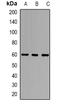 ADA1D antibody, orb382461, Biorbyt, Western Blot image 