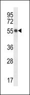 Hepatocyte cell adhesion molecule antibody, 56-688, ProSci, Western Blot image 