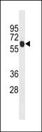 Enolase 4 antibody, PA5-49055, Invitrogen Antibodies, Western Blot image 