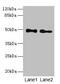 Abhydrolase Domain Containing 2 antibody, CSB-PA001094LA01HU, Cusabio, Western Blot image 