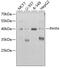 Phytanoyl-CoA 2-Hydroxylase antibody, GTX54557, GeneTex, Western Blot image 