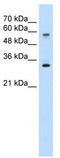 Solute Carrier Family 22 Member 1 antibody, TA346143, Origene, Western Blot image 