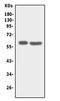 Solute Carrier Family 22 Member 6 antibody, LS-C312836, Lifespan Biosciences, Western Blot image 