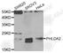 Pleckstrin Homology Like Domain Family A Member 2 antibody, A6244, ABclonal Technology, Western Blot image 