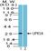 Uroplakin 3A antibody, M06534, Boster Biological Technology, Western Blot image 