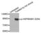Heat Shock Protein 90 Alpha Family Class B Member 1 antibody, LS-C335867, Lifespan Biosciences, Western Blot image 
