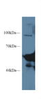 Amylase Alpha 1C (Salivary) antibody, LS-C303465, Lifespan Biosciences, Western Blot image 