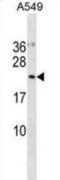 Ubiquitin-Fold Modifier Conjugating Enzyme 1 antibody, abx031201, Abbexa, Western Blot image 