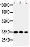 HOX1D antibody, PA1603, Boster Biological Technology, Western Blot image 