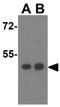 STEAP3 Metalloreductase antibody, GTX85434, GeneTex, Western Blot image 