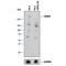 Leucine Rich Repeat Kinase 2 antibody, NB110-58771, Novus Biologicals, Western Blot image 