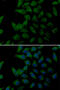 Procollagen-Lysine,2-Oxoglutarate 5-Dioxygenase 2 antibody, abx005269, Abbexa, Western Blot image 