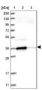 N-Acetylglucosamine Kinase antibody, PA5-57195, Invitrogen Antibodies, Western Blot image 