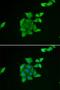 Tumor Suppressor 2, Mitochondrial Calcium Regulator antibody, LS-C335709, Lifespan Biosciences, Immunofluorescence image 