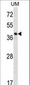 Speckle Type BTB/POZ Protein Like antibody, LS-B10543, Lifespan Biosciences, Western Blot image 