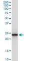 Glutathione S-transferase A1 antibody, H00002938-M08, Novus Biologicals, Western Blot image 