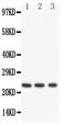 Ribonuclease A Family Member 4 antibody, PA1564, Boster Biological Technology, Western Blot image 