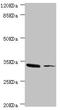 Monoglyceride Lipase antibody, LS-C676045, Lifespan Biosciences, Western Blot image 