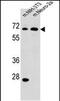 Malic Enzyme 2 antibody, PA5-48407, Invitrogen Antibodies, Western Blot image 