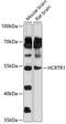 Hypocretin Receptor 1 antibody, 15-697, ProSci, Western Blot image 