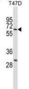 ABS antibody, abx031020, Abbexa, Western Blot image 