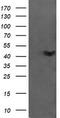 Ciliogenesis Associated TTC17 Interacting Protein antibody, CF505575, Origene, Western Blot image 