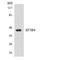 Splicing Factor 3b Subunit 4 antibody, LS-C200659, Lifespan Biosciences, Western Blot image 