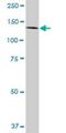 Polyhomeotic Homolog 1 antibody, H00001911-D01P, Novus Biologicals, Western Blot image 