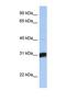 Beta-1,3-Galactosyltransferase 6 antibody, NBP1-69396, Novus Biologicals, Western Blot image 