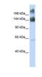 Kinectin 1 antibody, NBP1-91592, Novus Biologicals, Western Blot image 