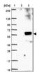 Solute Carrier Family 45 Member 3 antibody, NBP1-89629, Novus Biologicals, Western Blot image 